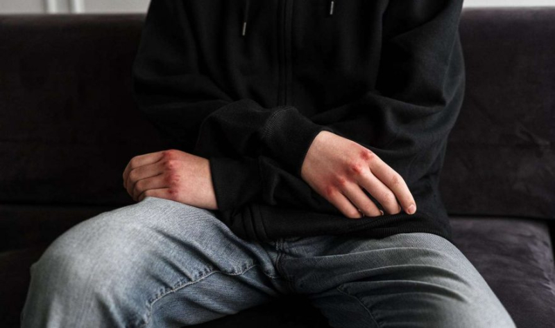 В Одессе сотрудник военкомата избил 19-летнюю девушку костылем